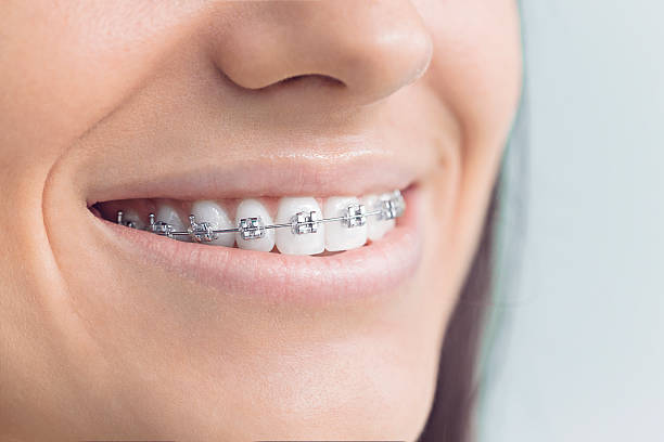Trusted Blue Ash, OH Holistic Dental Care Services Experts